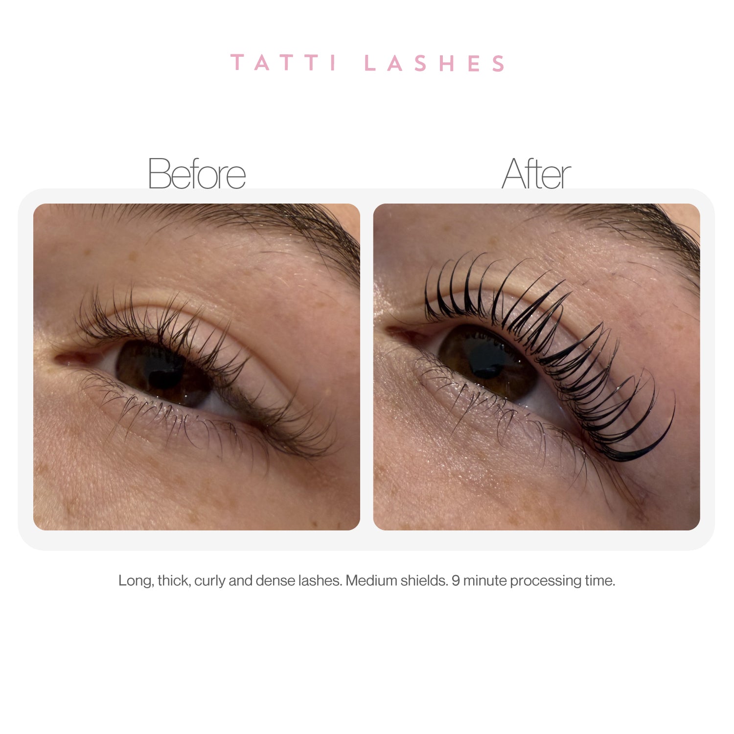 Medium Lash Shields